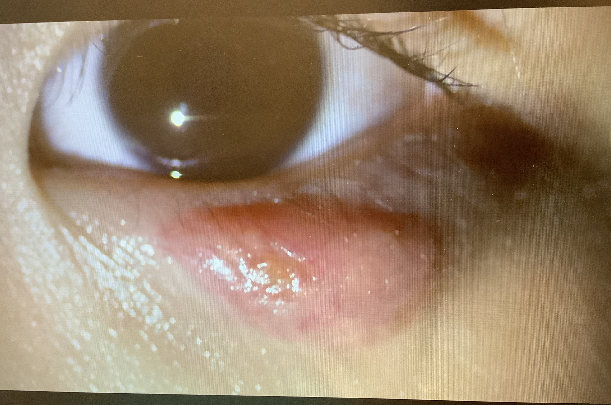 お子さんへの説明 - たまプラーザやまぐち眼科