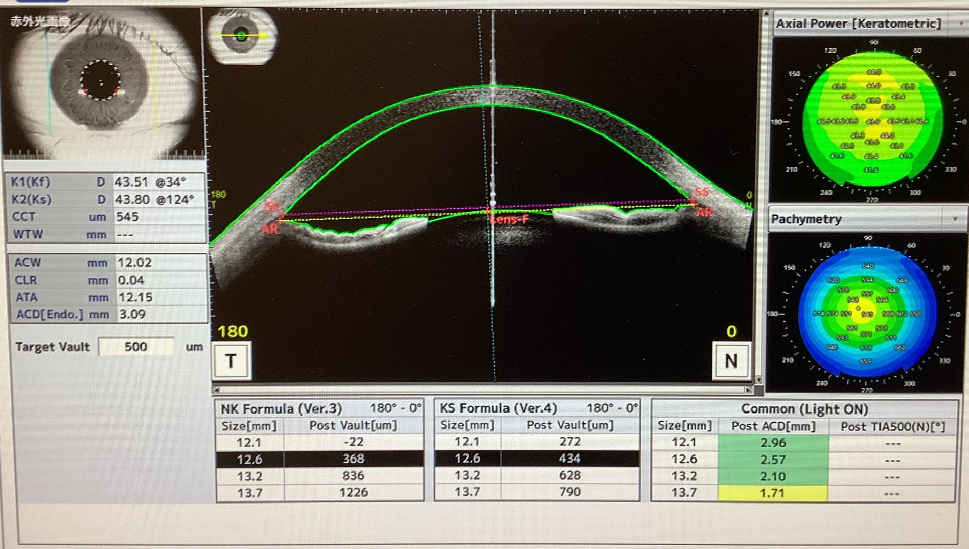 (裁断済み)眼科プラクティス24 見た目が大事！眼腫瘍 裁断済み)眼科プラクティス24 見た目が大事！眼腫瘍 裁断済み
