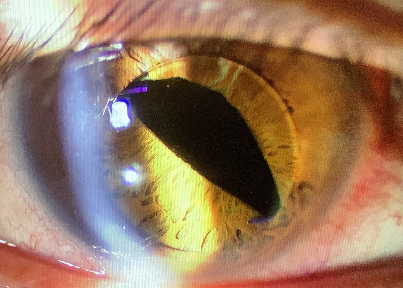 2025年手術初め - たまプラーザやまぐち眼科