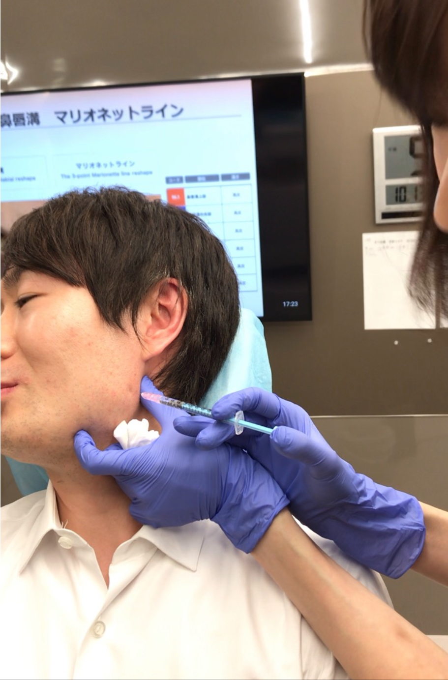 ボトックスの注射 - たまプラーザやまぐち眼科