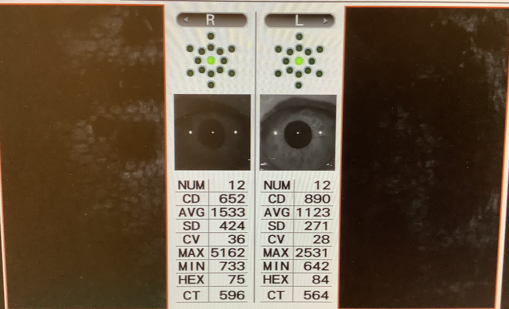 口腔内科学 製品詳細「ルートZX3」 | フォルディネット