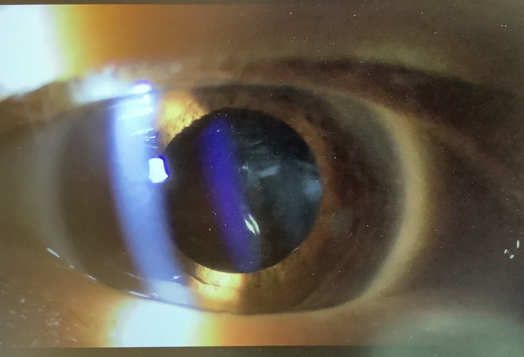 左右は揃えないと？ - たまプラーザやまぐち眼科