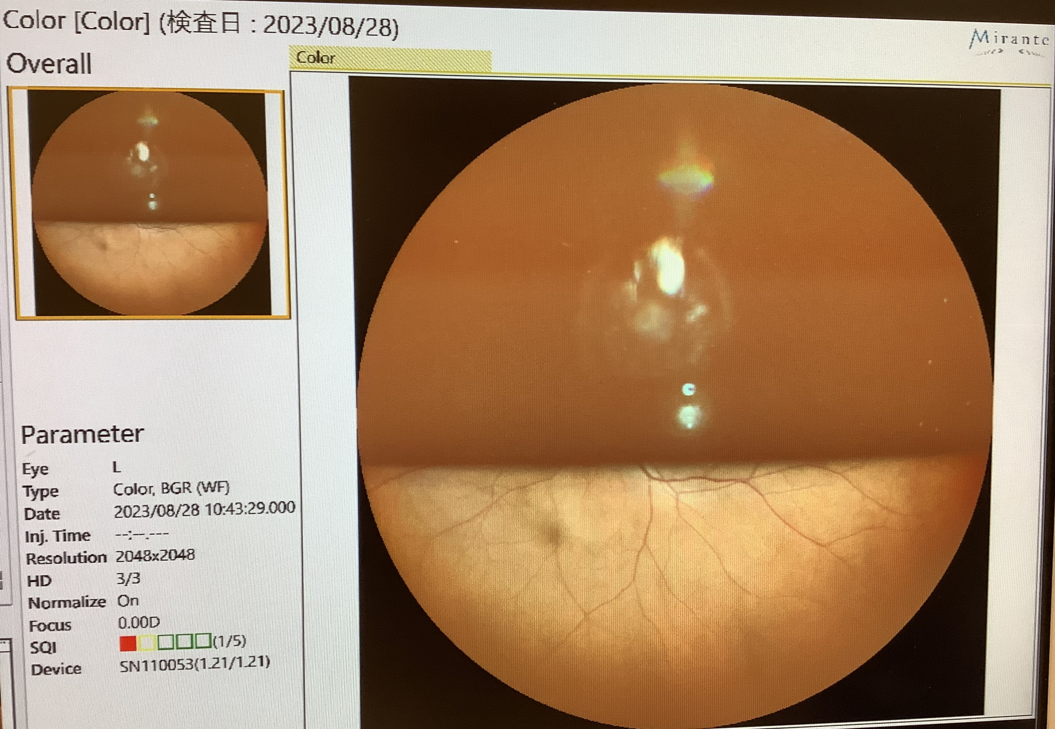 まだガスがあるのは - たまプラーザやまぐち眼科